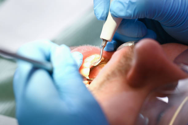 Best Weekend Emergency Dentist in Herscher, IL